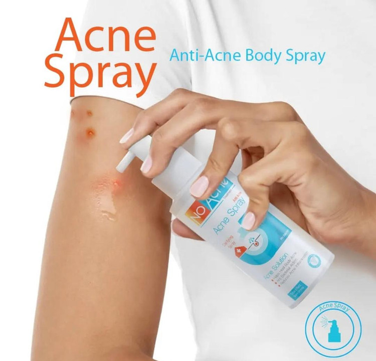 اسپری ضد جوش بدن نو آکنه